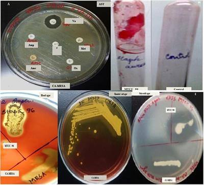 Fatty Acid Methyl Esters From the Coral-Associated Bacterium Pseudomonas aeruginosa Inhibit Virulence and Biofilm Phenotypes in Multidrug Resistant Staphylococcus aureus: An in vitro Approach